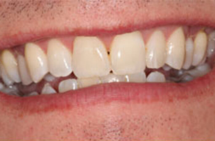 Before - Cheadle Hulme Dental