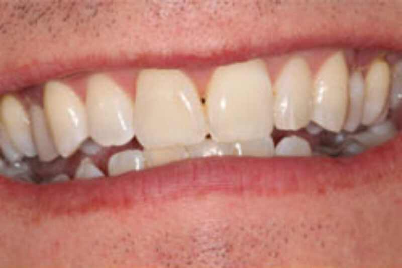 Before - Cheadle Hulme Dental