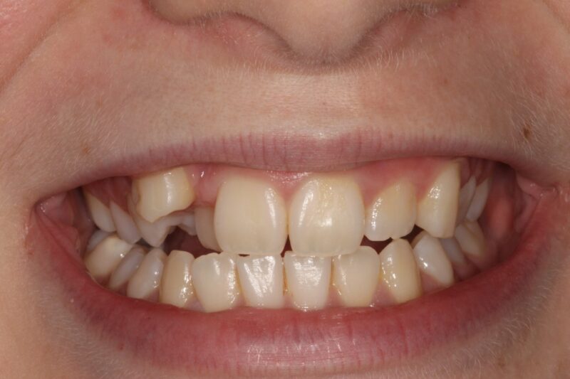 Before - Cheadle Hulme Dental