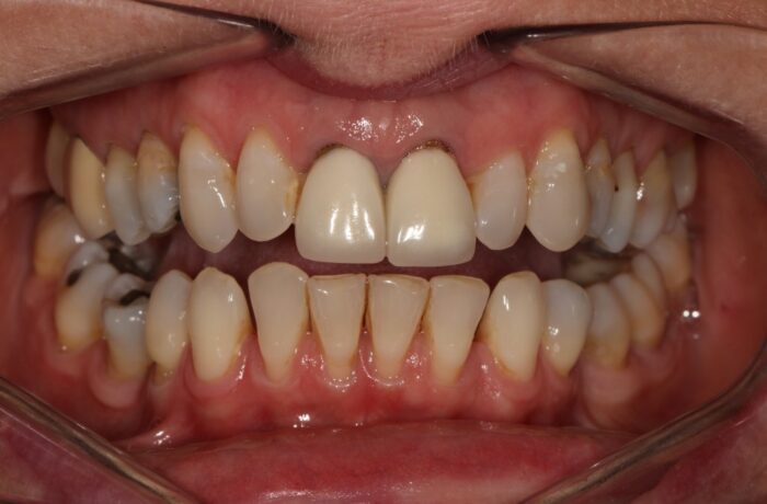 Before - Cheadle Hulme Dental