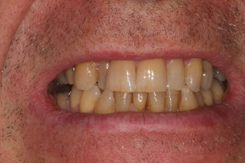 Before - Cheadle Hulme Dental