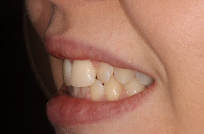 Before - Cheadle Hulme Dental