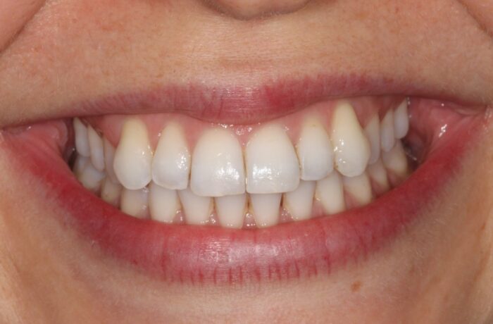 Before - Cheadle Hulme Dental
