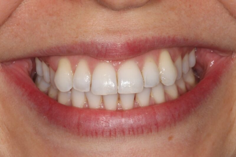 Before - Cheadle Hulme Dental
