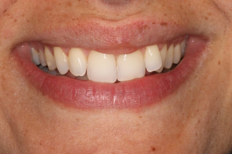 Before - Cheadle Hulme Dental