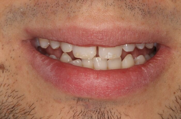 Before - Cheadle Hulme Dental