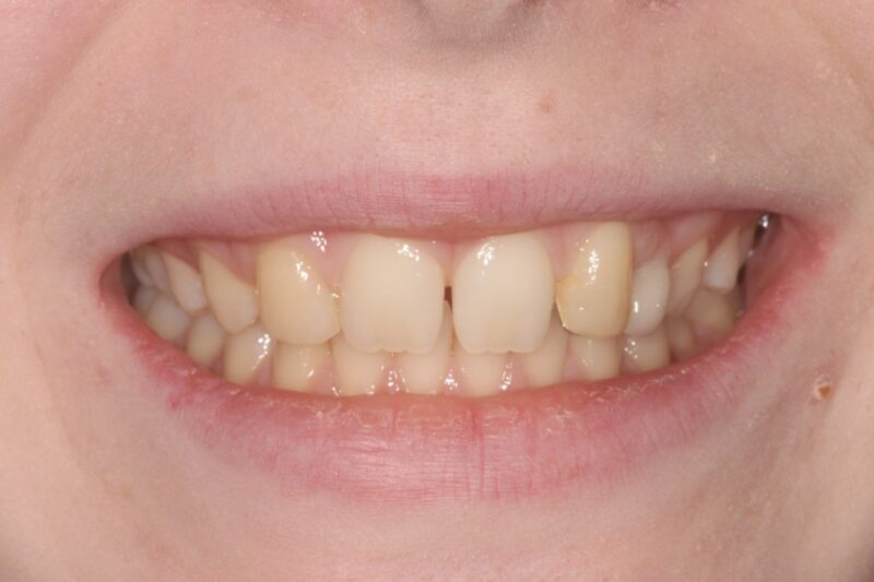 Before - Cheadle Hulme Dental