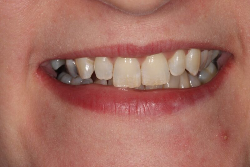 Before - Cheadle Hulme Dental