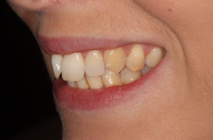 Before - Cheadle Hulme Dental