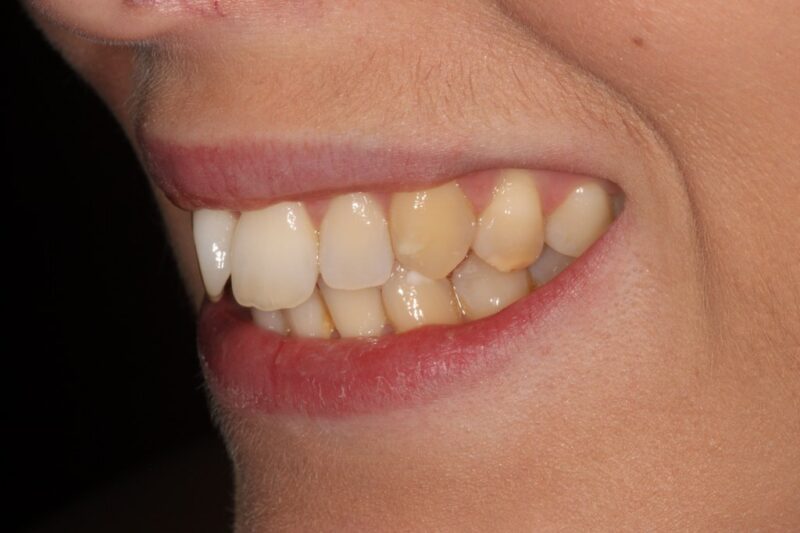 Before - Cheadle Hulme Dental