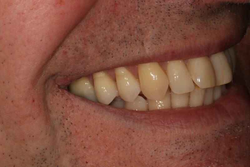 Before - Cheadle Hulme Dental