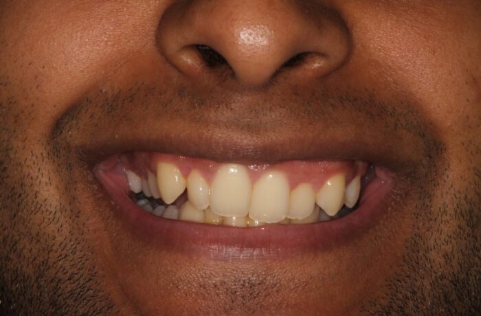 Before - Cheadle Hulme Dental