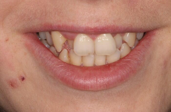 Before - Cheadle Hulme Dental