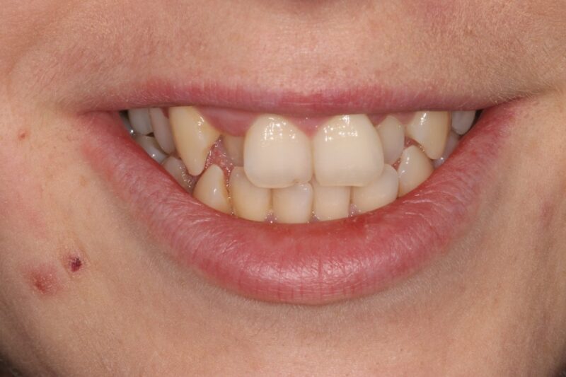 Before - Cheadle Hulme Dental