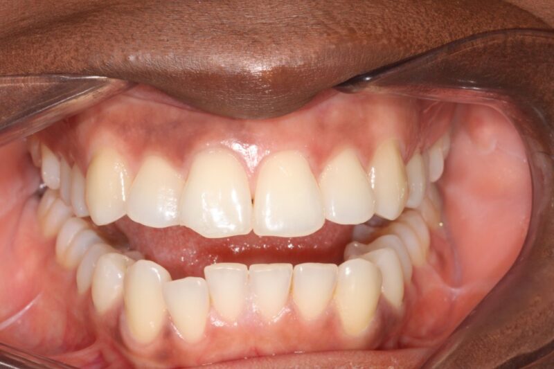 Before - Cheadle Hulme Dental