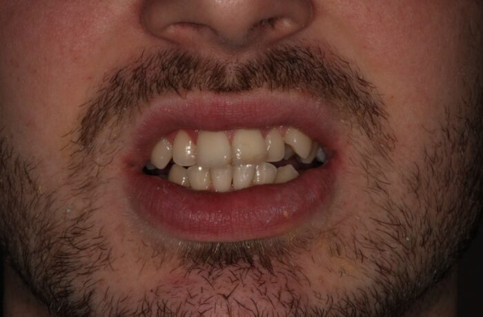 Before - Cheadle Hulme Dental