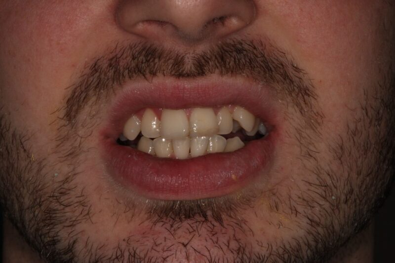 Before - Cheadle Hulme Dental