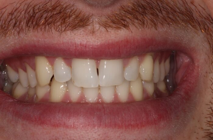 Before - Cheadle Hulme Dental