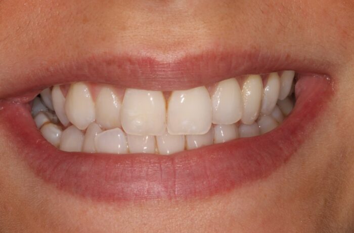 Before - Cheadle Hulme Dental