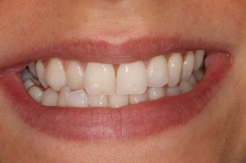 Before - Cheadle Hulme Dental