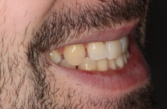 Before - Cheadle Hulme Dental
