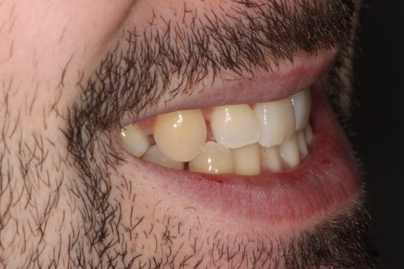 Before - Cheadle Hulme Dental