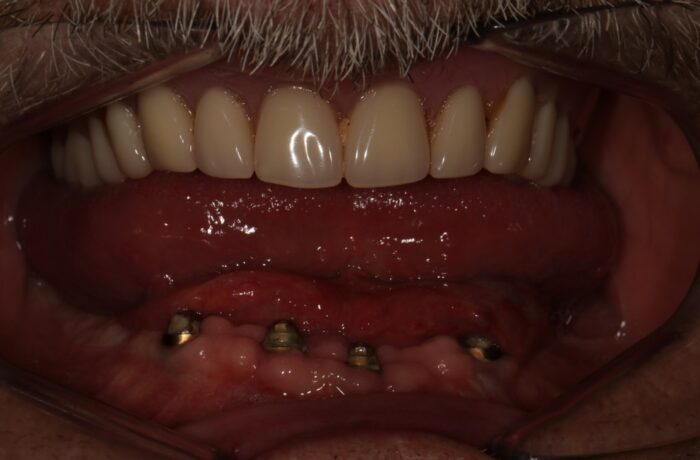 Before - Cheadle Hulme Dental