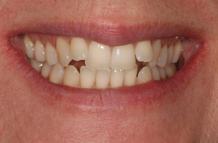 Before - Cheadle Hulme Dental