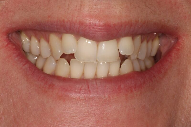 Before - Cheadle Hulme Dental