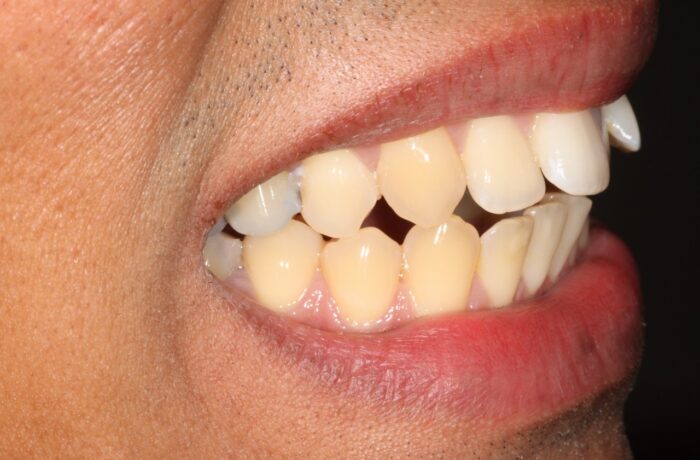 Before - Cheadle Hulme Dental