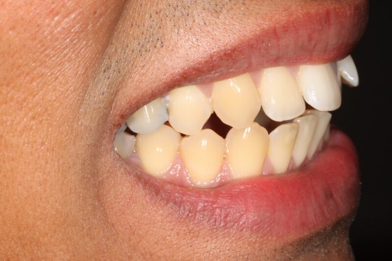 Before - Cheadle Hulme Dental