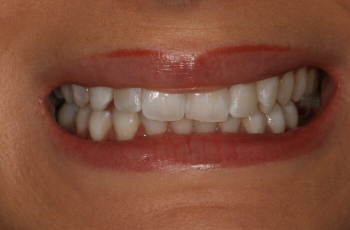 Before - Cheadle Hulme Dental