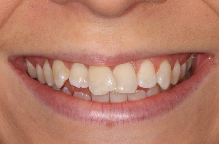 Before - Cheadle Hulme Dental