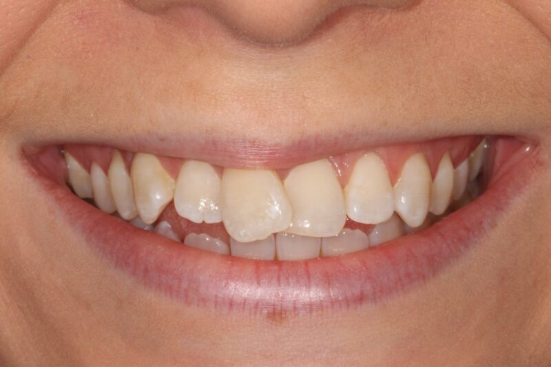 Before - Cheadle Hulme Dental