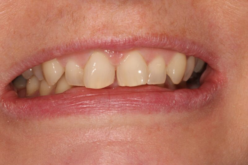 Before - Cheadle Hulme Dental