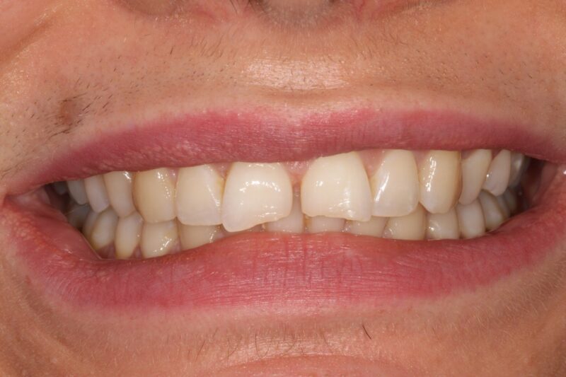 Before - Cheadle Hulme Dental