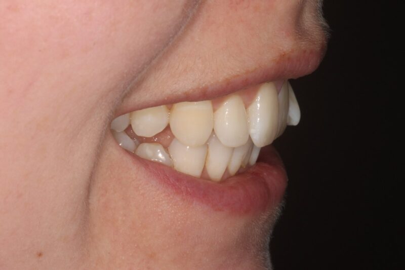 Before - Cheadle Hulme Dental