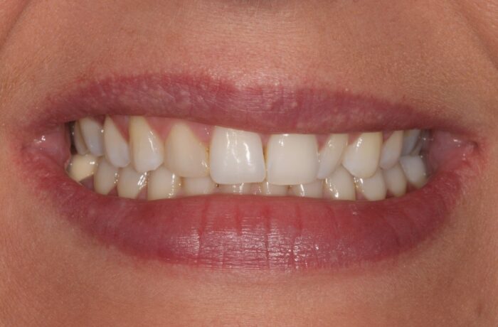 Before - Cheadle Hulme Dental