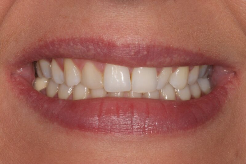 Before - Cheadle Hulme Dental