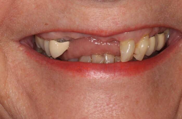 Before - Cheadle Hulme Dental