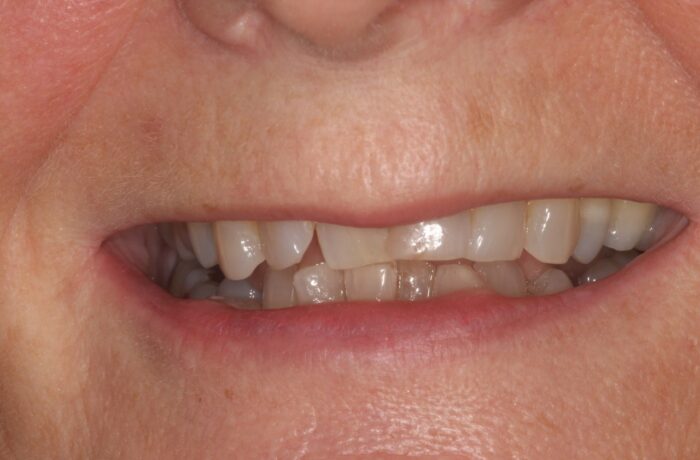 Before - Cheadle Hulme Dental