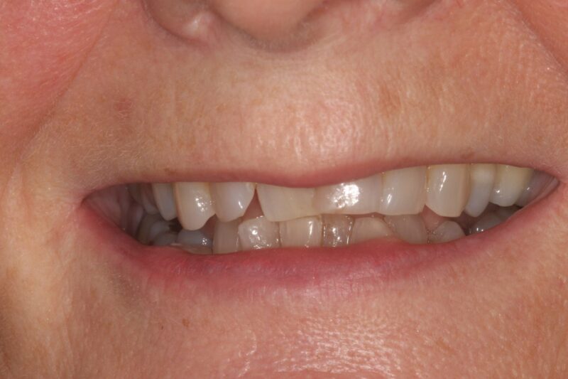 Before - Cheadle Hulme Dental