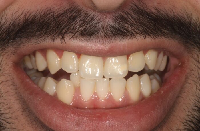 Before - Cheadle Hulme Dental