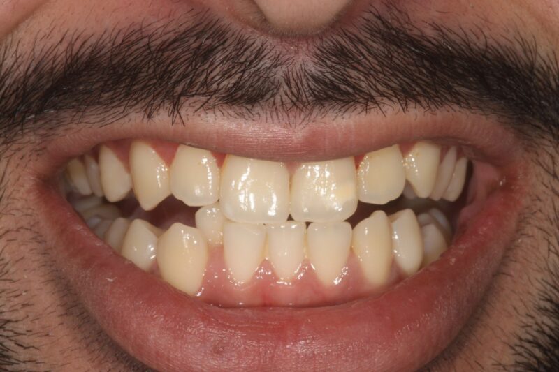 Before - Cheadle Hulme Dental