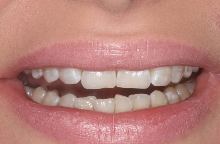 Before - Cheadle Hulme Dental