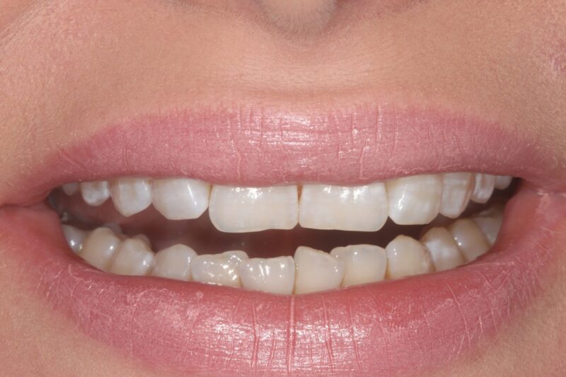 Before - Cheadle Hulme Dental