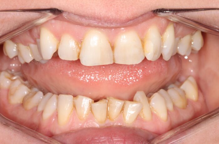 Before - Cheadle Hulme Dental
