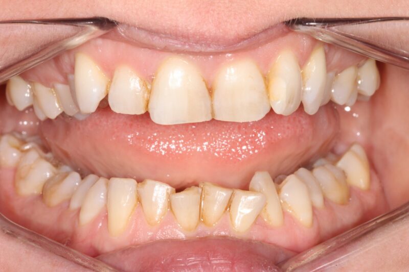 Before - Cheadle Hulme Dental