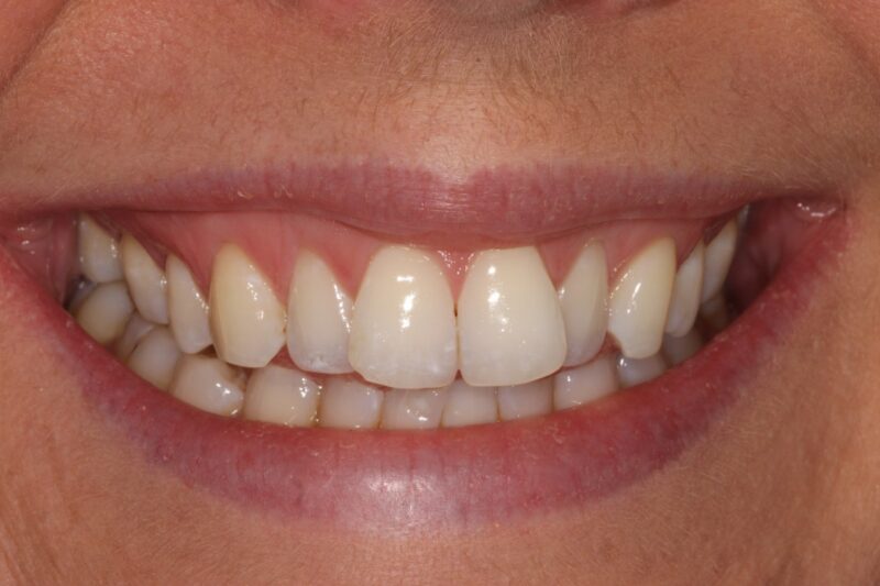 Before - Cheadle Hulme Dental