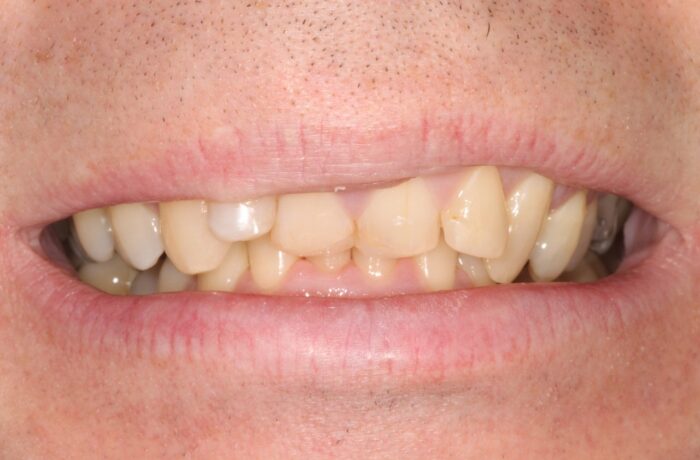 Before - Cheadle Hulme Dental